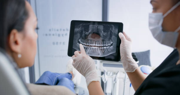 Licensed Tooth Extraction service in East Orange, NJ - Smile Center Dentistry